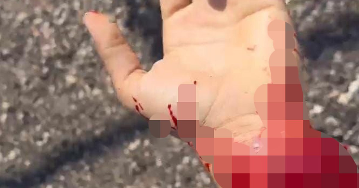 צעיר הותקף קשות במכון שטיפה: "ויכוח סתמי כמעט הסתיים ברצח"