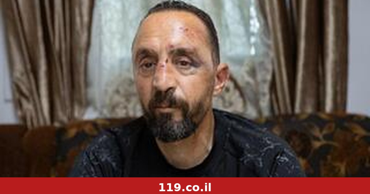 נהג האוטובוס שהותקף, ישב מאחורי ההגה: "היינו יכולים להידרדר על אנשים ברחוב"