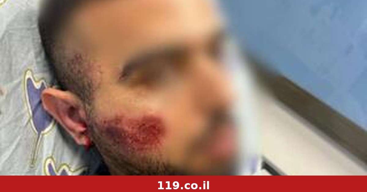 "שוטרים פוצצו אותי במכות": תלונת נאשם בפריצה - והביקורת של בית המשפט