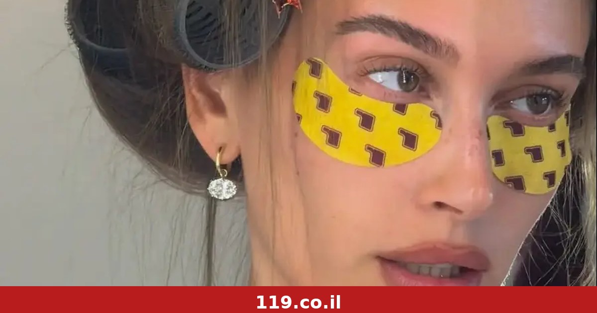 סליחה שנשרפנו: הריסט שהעור של כולנו חייב אחרי הקיץ הזה