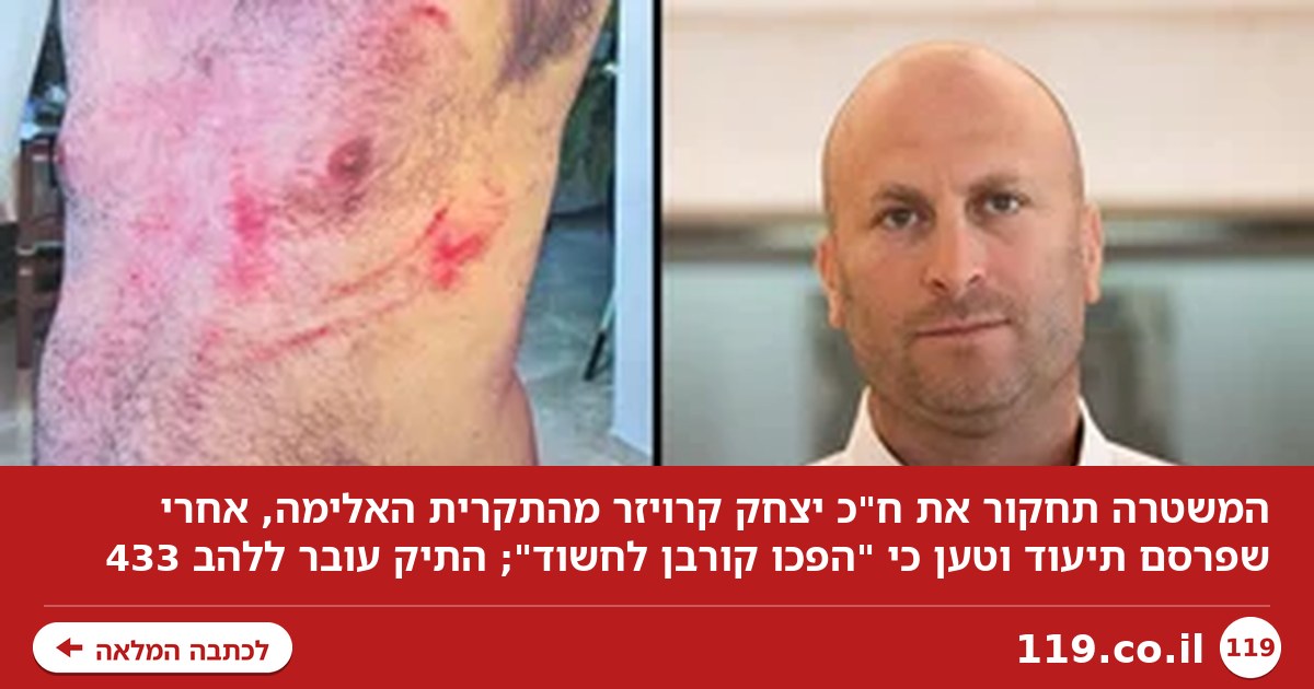 המשטרה תחקור את חבר הכנסת מהתקרית האלימה; הוא פרסם תיעוד: "הפכו קורבן לחשוד"