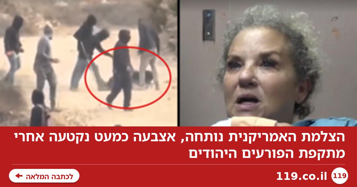 הצלמת האמריקנית נותחה, אצבעה כמעט נקטעה אחרי מתקפת הפורעים היהודים