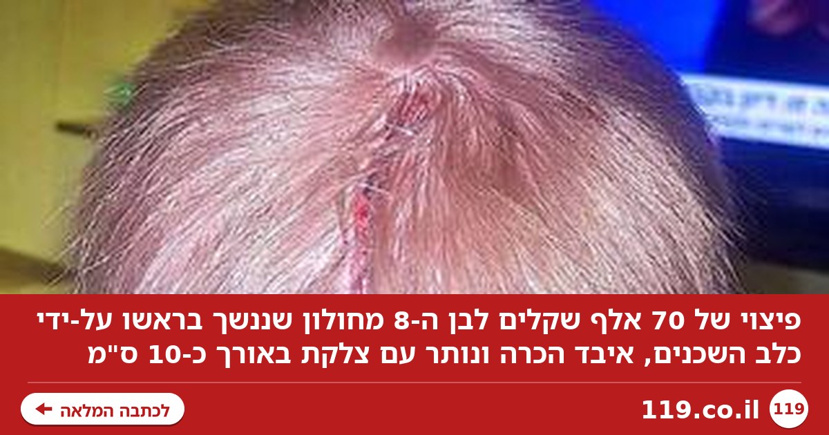 פיצוי של 70 אלף שקלים לבן ה-8 שננשך על-ידי הכלב של שכנו
