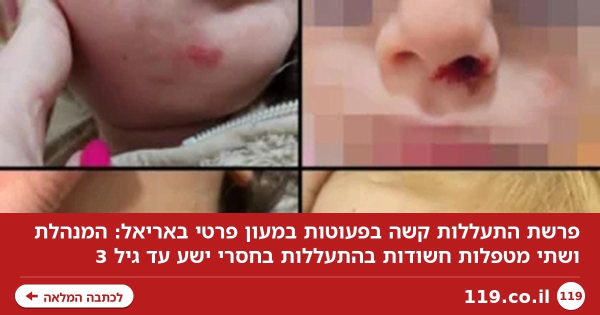 חנקו, טלטלו, סטרו והטיחו: פרשת התעללות קשה בפעוטות במעון באריאל